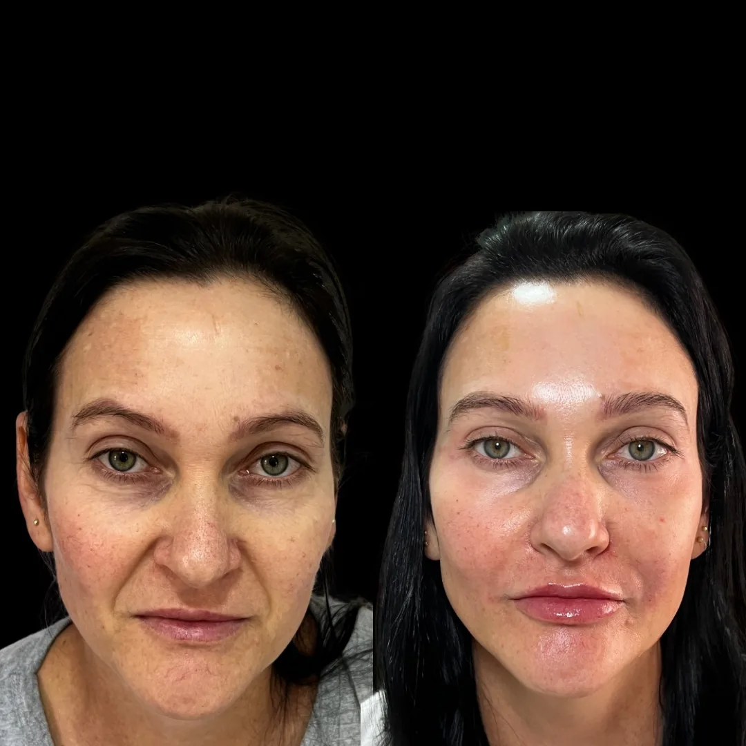 Full Face - Pommerdent